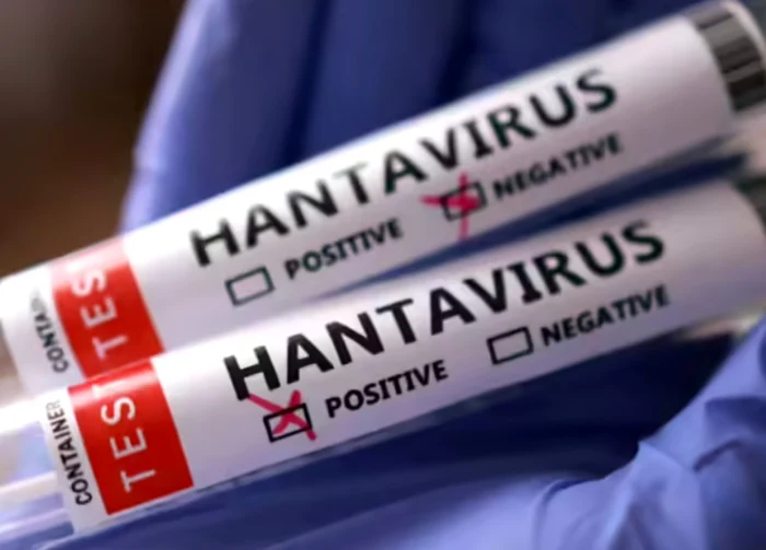 Primul caz de hantavirus certificat în România. Pacient spitalizat la Arad, transferat din Bihor având simptome. Primul caz de hantavirus certificat în România. Pacient spitalizat la Arad, transferat din Bihor având simptome.